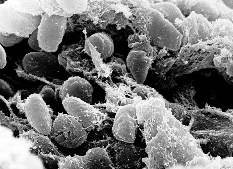 800px-Yersinia_pestis.jpg